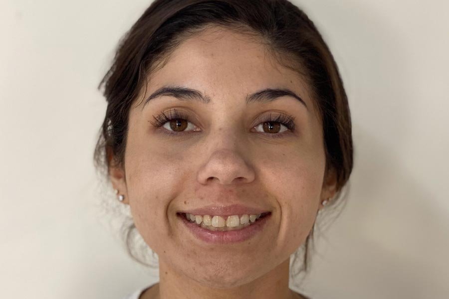 periodent-co-tijuana-dentist-dr-alejandra-gonzalez-before-after-periodontics-case-09-3