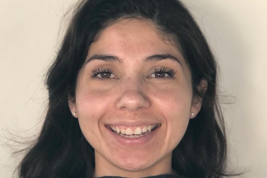 periodent-co-tijuana-dentist-dr-alejandra-gonzalez-before-after-periodontics-case-09-4 periodent-co-tijuana-dentist-dr-alejandra-gonzalez-before-after-periodontics-case-09-4